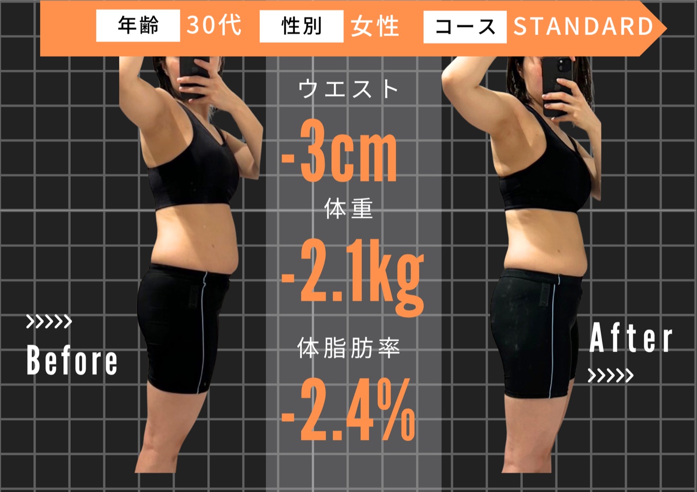 30代 女性 ／ STANDARDコース ビフォーアフター
